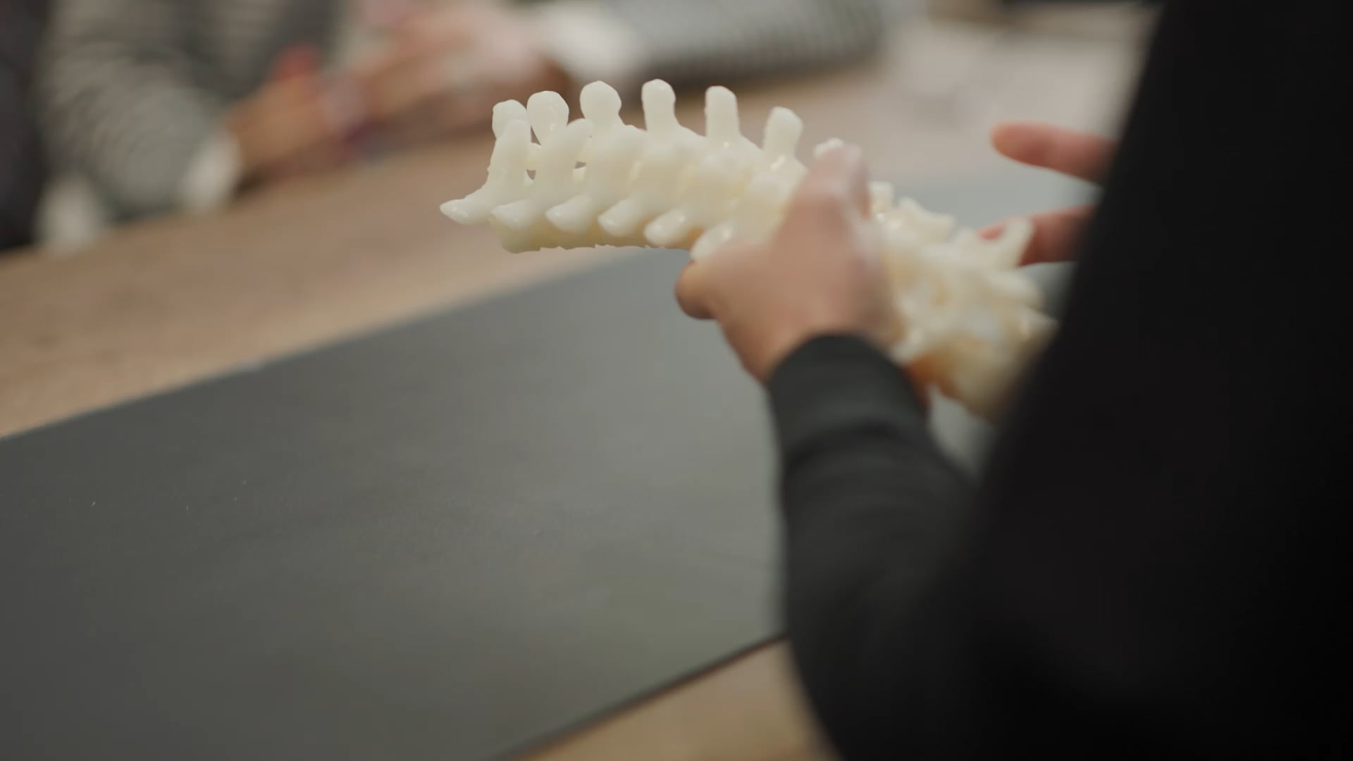 Epworth-Scoliosis-Patients